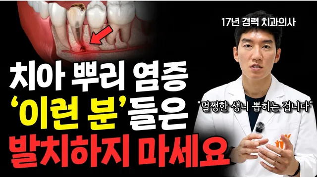 발치 일단 하지 마세요! 절대 되돌릴 수 없습니다.