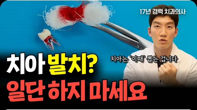 치아 발치 적정 시기? 후회하지 않는 선택기준 알려드립니다.